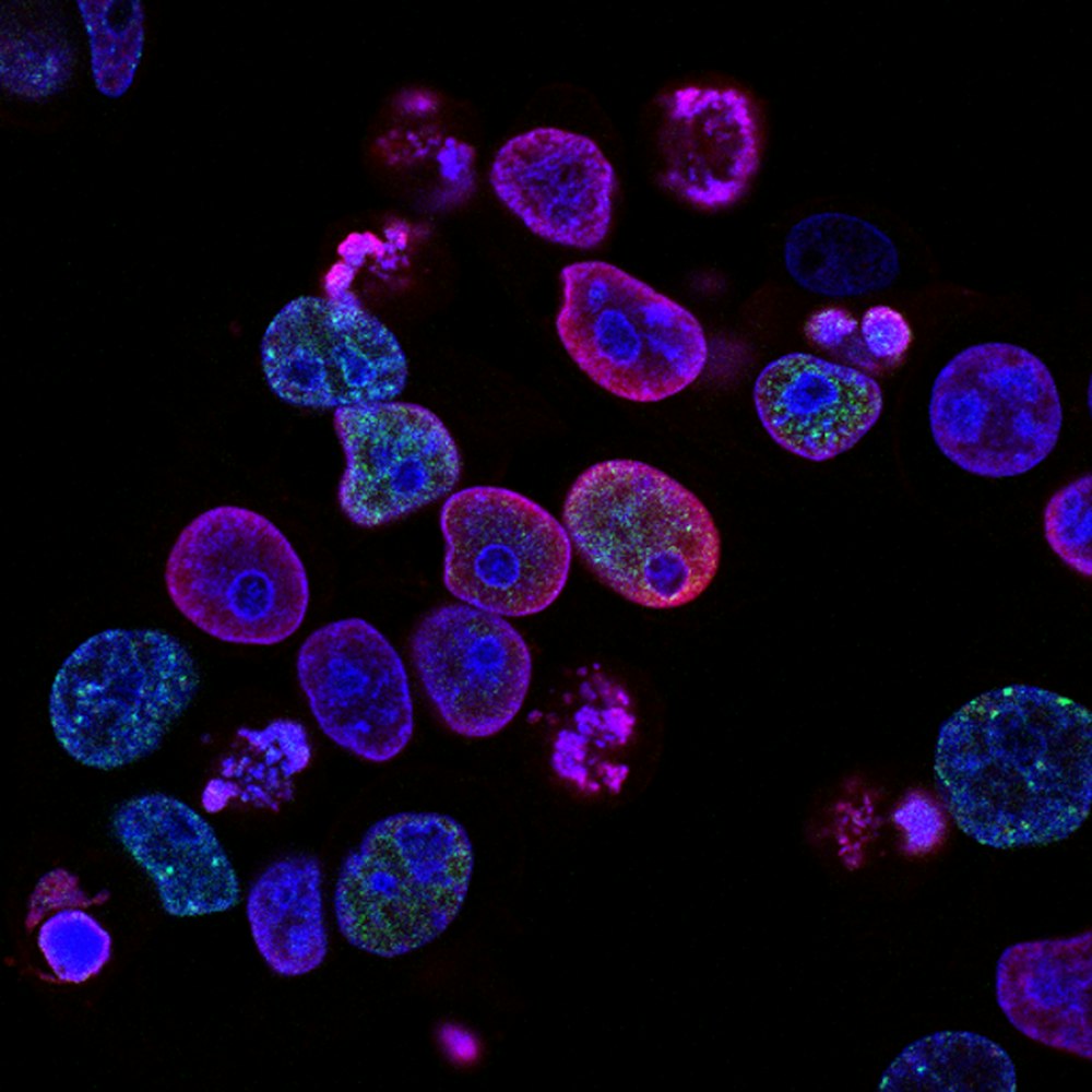 Fluorescence microscopy image of cells used in scientific research